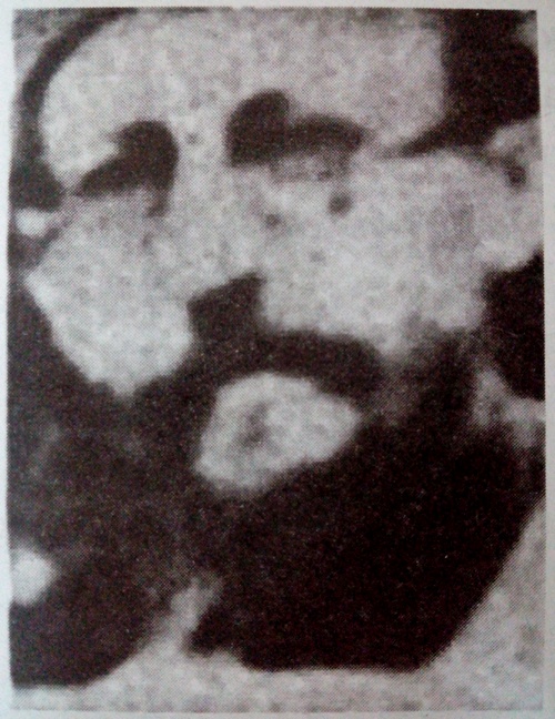 Якуб Харэўскі